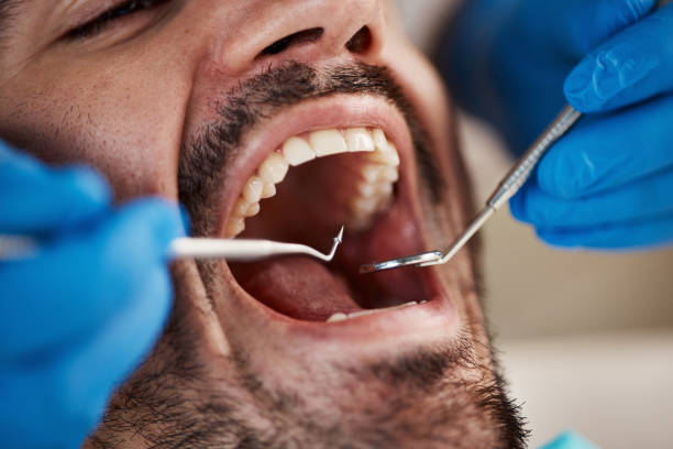 Best Broken or Chipped Tooth Repair in Dousman, WI
