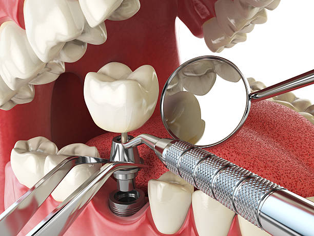 Best Emergency Treatment for Oral Infections in Dousman, WI